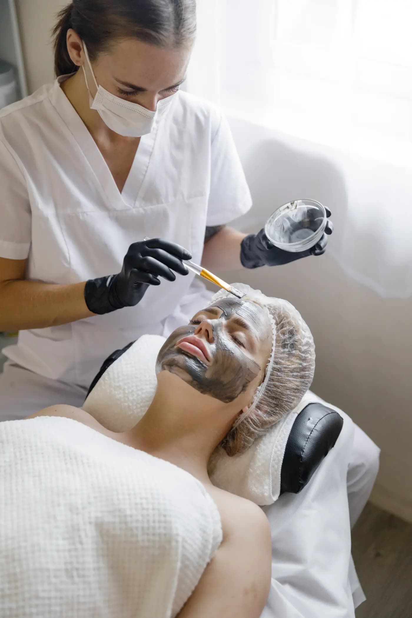 Face SMAS lifting — Después